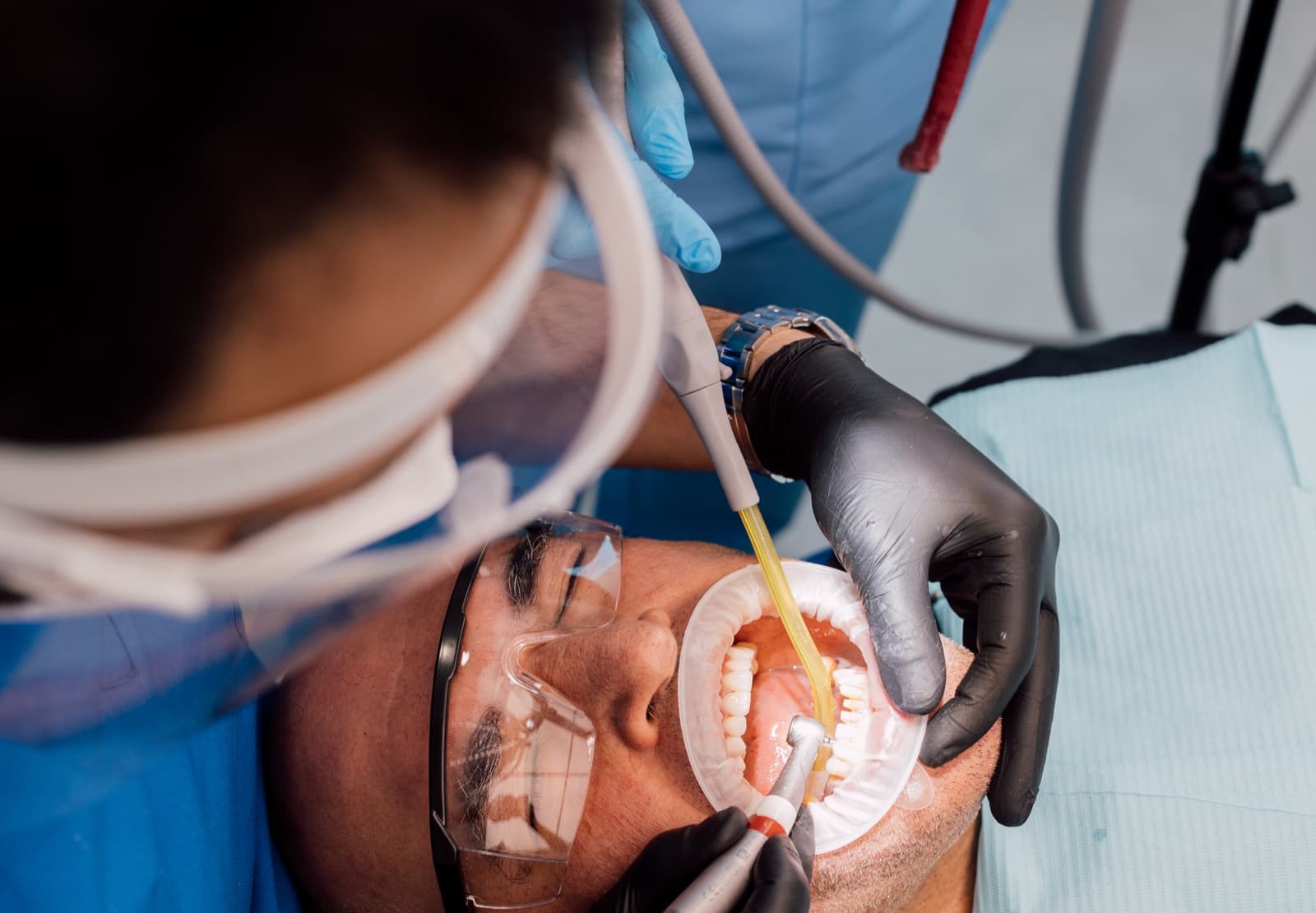 Crowns and Dental Bridges, Prosthodontics & Cosmetic Dentistry