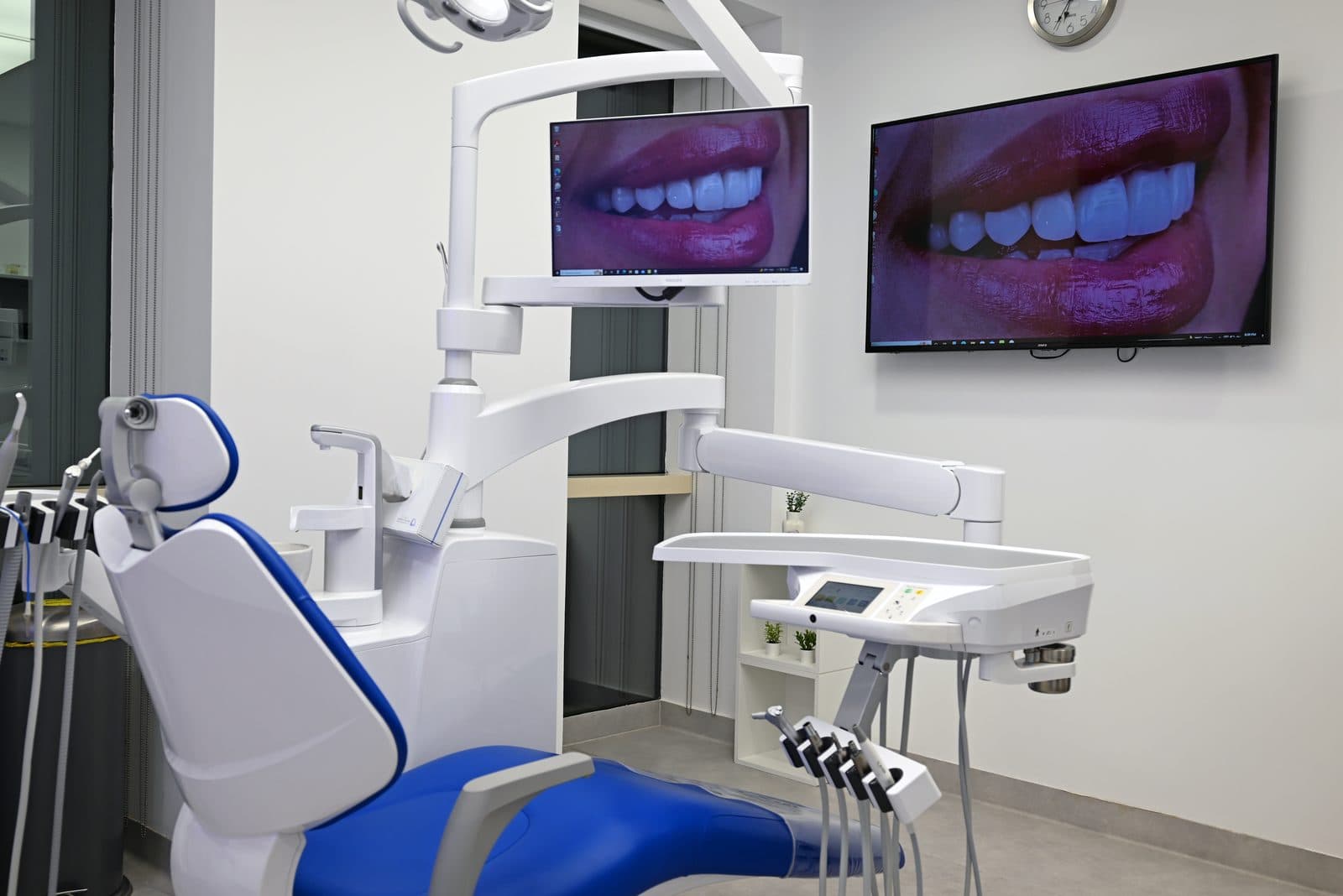 Blanchiment Dentaire, Dentisterie Générale
